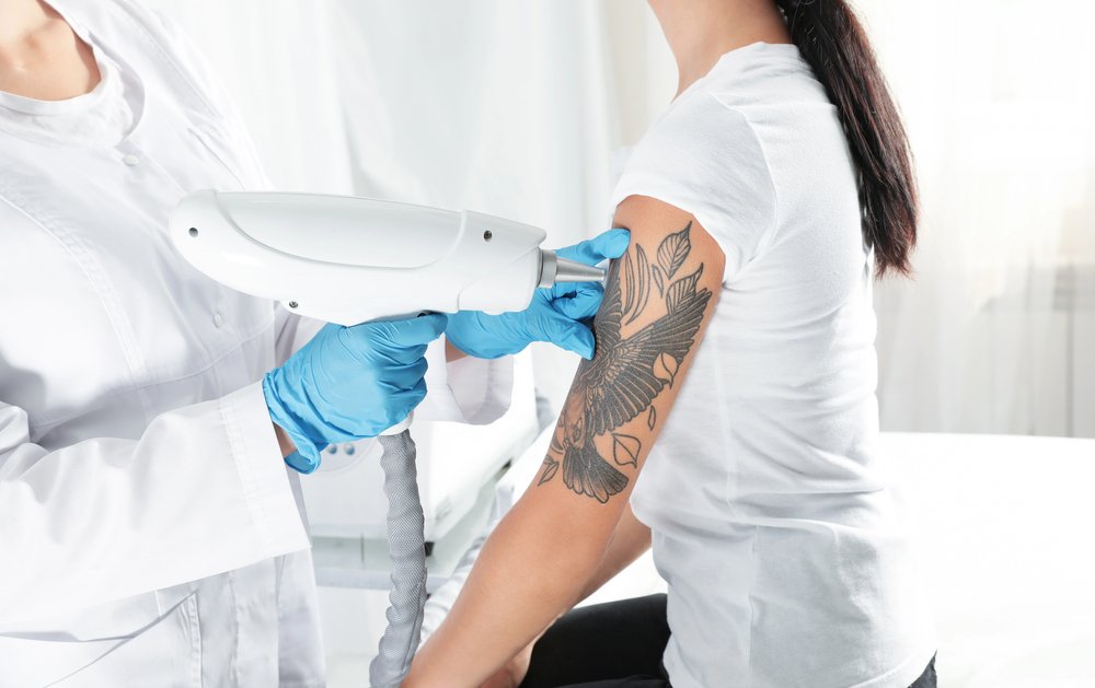 tatto-removal-clinic Tatto Removal Clinic