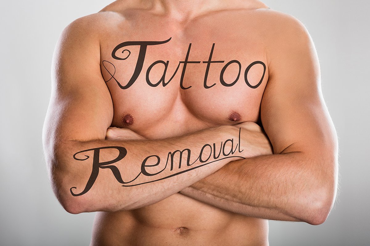 tattoo-removal-male Tattoo Removal Men